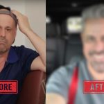 Bye Bye Hats! 90 Day Fiance Star Gino Palazzolo Got A Hair Transplant? [See Picture Here]