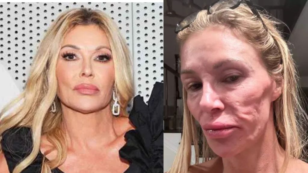 RHOBH