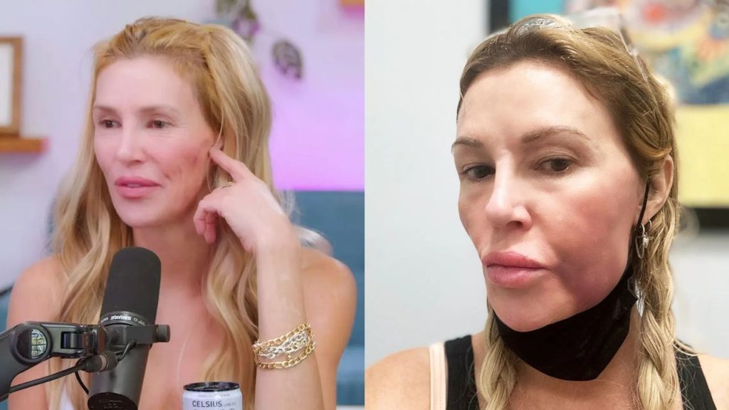 RHOBH